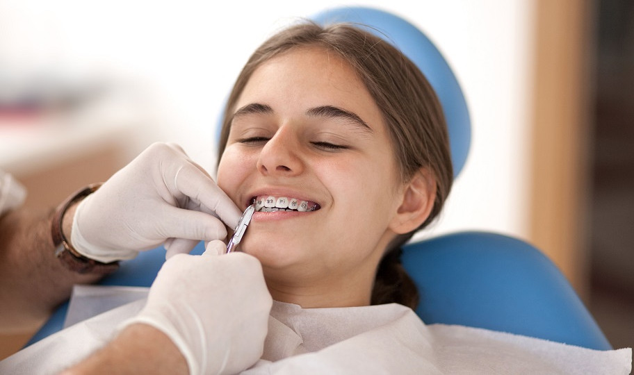 Установка самолигирующихся металлических брекетов Установка самолигирующихся металлических брекетов